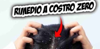 capelli forfora disagio