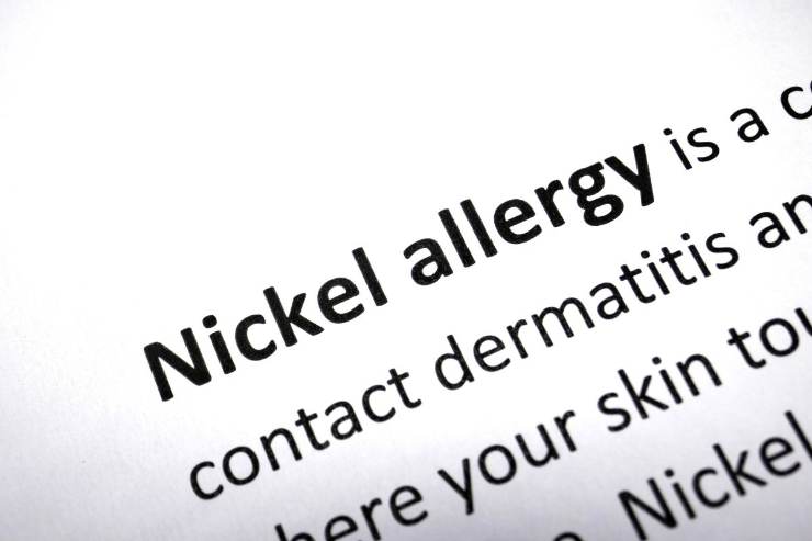 allergia da nichel